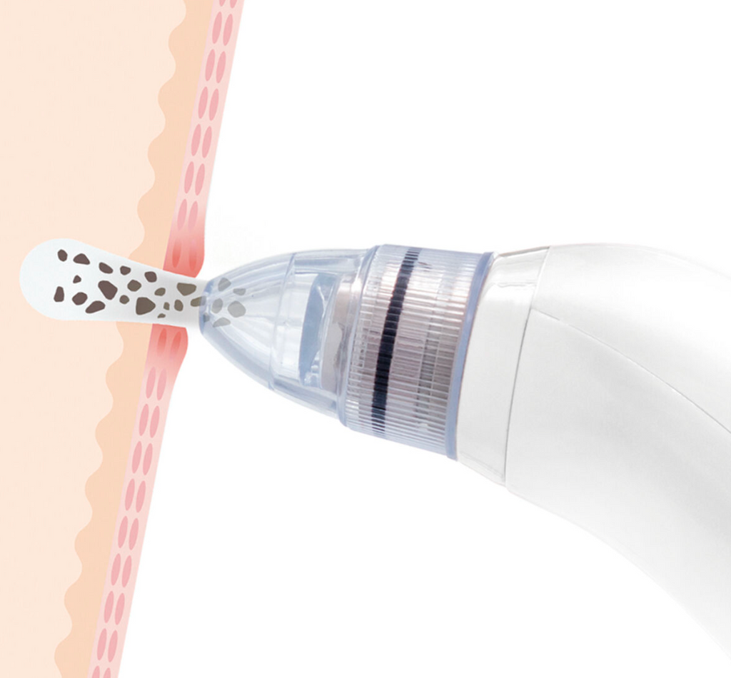 Pore·Off Electric Blackhead Remover